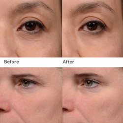 NeoStrata Enlighten Brightening Eye Cream, 15g