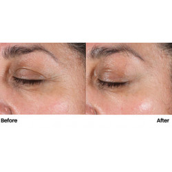 NeoStrata Skin Active Tri-Therapy Lifting Serum, 30ml