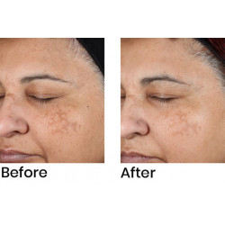 NeoStrata Enlighten Dark spot Corrector, 20g